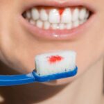 how to cure gum disease at home