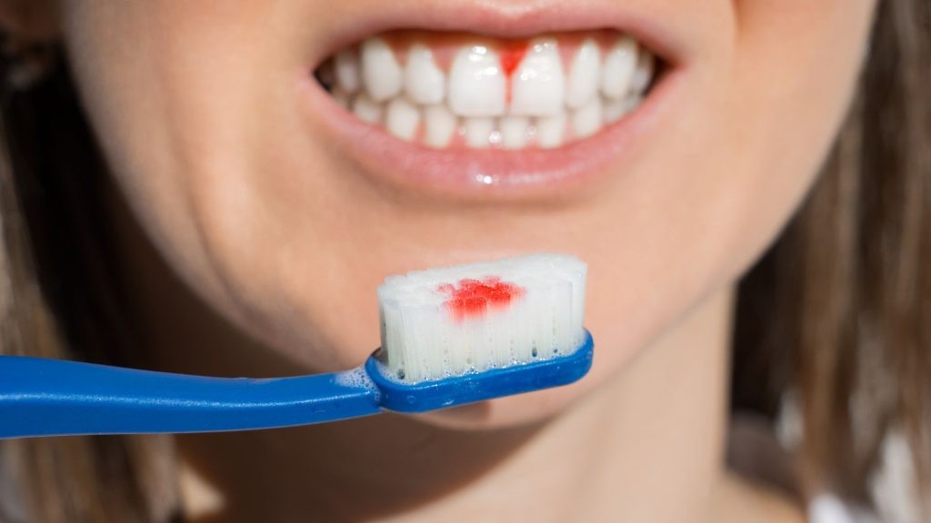 how to cure gum disease at home